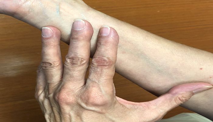 Membership Matters: Don't be Shy, Check your Skin